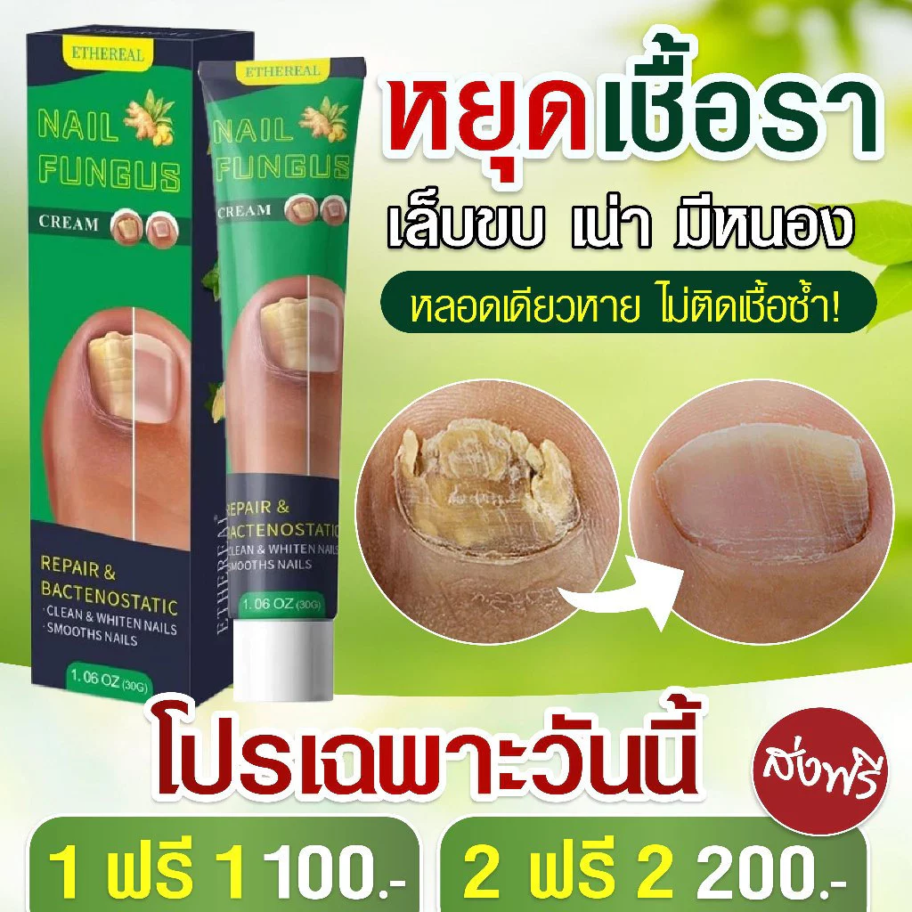 ครีมกันเชื้อราเล็บ เล็บสวย แข็งแรง สุขภาพดี