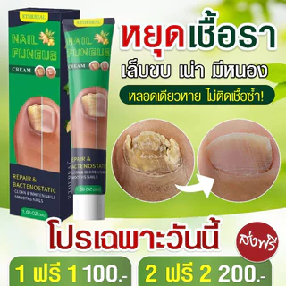 ครีมกันเชื้อราเล็บ เล็บสวย แข็งแรง สุขภาพดี