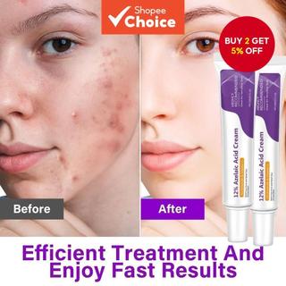 Azelaic Acid Serum: Hyaluronic & Niacinamide Brightening Formula — Skin Care Gift for Women