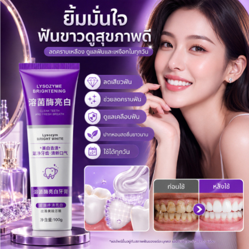 【ฟื้นฟูฟันเสีย】ยาสีฟันซ่อมแซมประสิทธิภาพสูง/ยาสีฟันซ่อมแซม/แก้ปัญหาหลุมฟันลึก