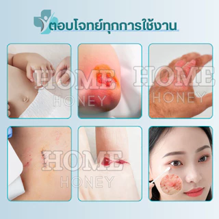 ก้านสำลีบรรจุเบ ตา ดีน ไอโอดีน50ชิ้น ทำแผลฉุกเฉิน พกพาสะดวก คัตตอนบัต ก้านฝ้าย ไม้พันสำลีปลอดเชื้อ สำลีก้าน