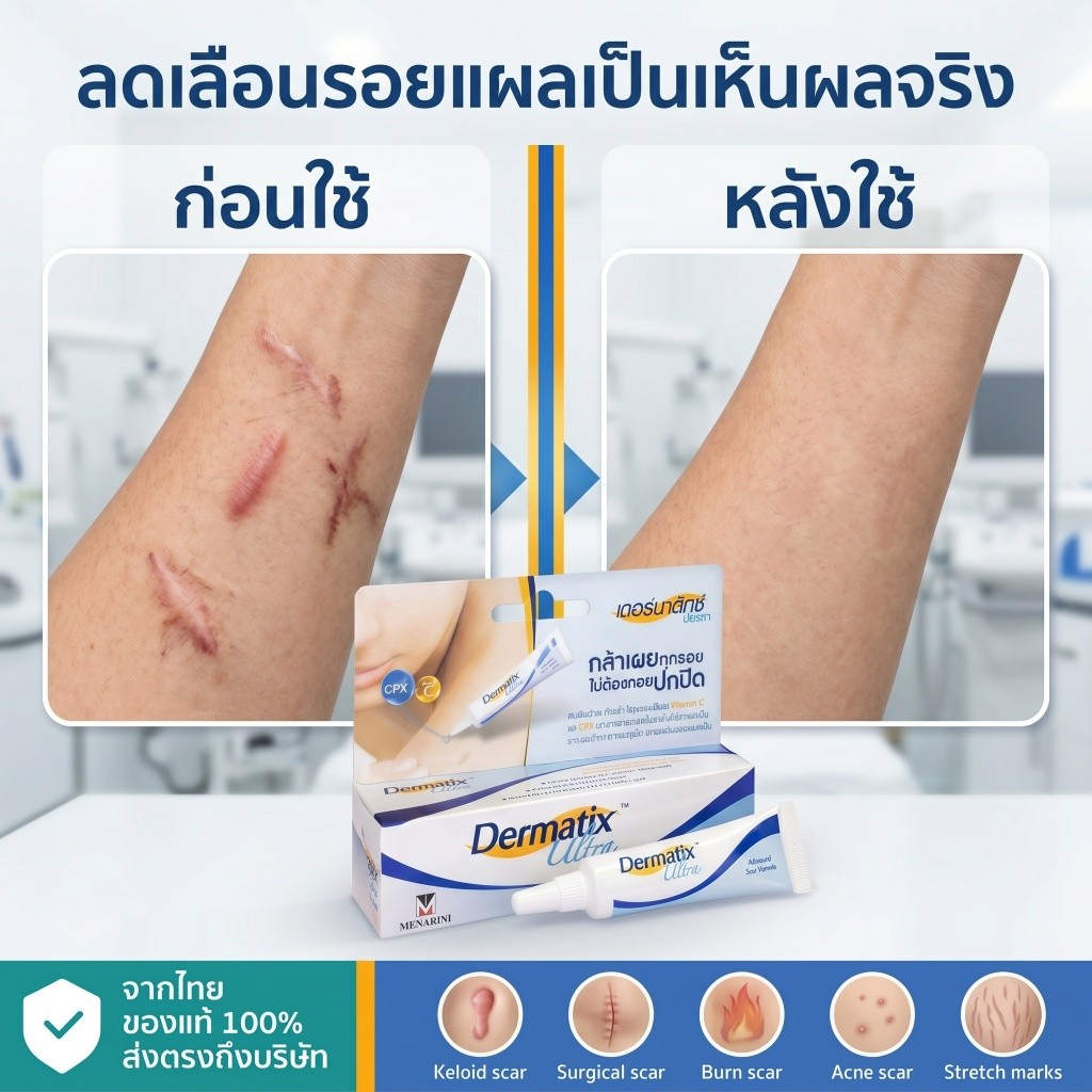 [รับประกันของแท้] Dermatix Ultra Gel 15g ผลลัพธ์ที่มองเห็นได้ใน 28 วันจางลงยกรอยแผลเป็นคืนสีผิว