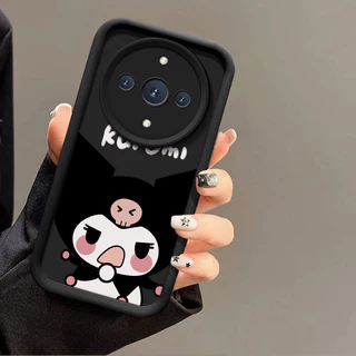 เคส honor x9d 5g เคสโทรศัพท์ป้องกันการล่มสลายน่ารัก