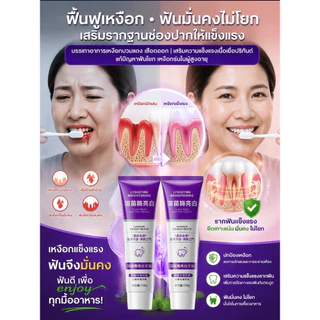 【ซ่อมหลุมผุเก่าได้】ซ่อมแซมฟัน/อุดฟัน/ฟื้นฟูฟัน/หลายฟังก์ชันในหนึ่ง/ครบจบในหลอดเดียว/หลากหลายในหนึ่งเดียว/หลุมผุเก่า/รอยผุเก่า/ฟันผุเรื้อรัง/ทำให้ฟันขาว/ป้องกันฟันผุ/ลดกลิ่นปาก