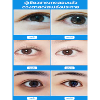 แผ่นมาสก์ตาไฮยาลูรอนิคให้ความชุ่มชื่นสำหรับตา/เพื่อเพิ่มความสดใส, ปรับปรุงริ้วรอย, บรรเทาความเมื่อยล้าของดวงตา/ลดรอยดำ