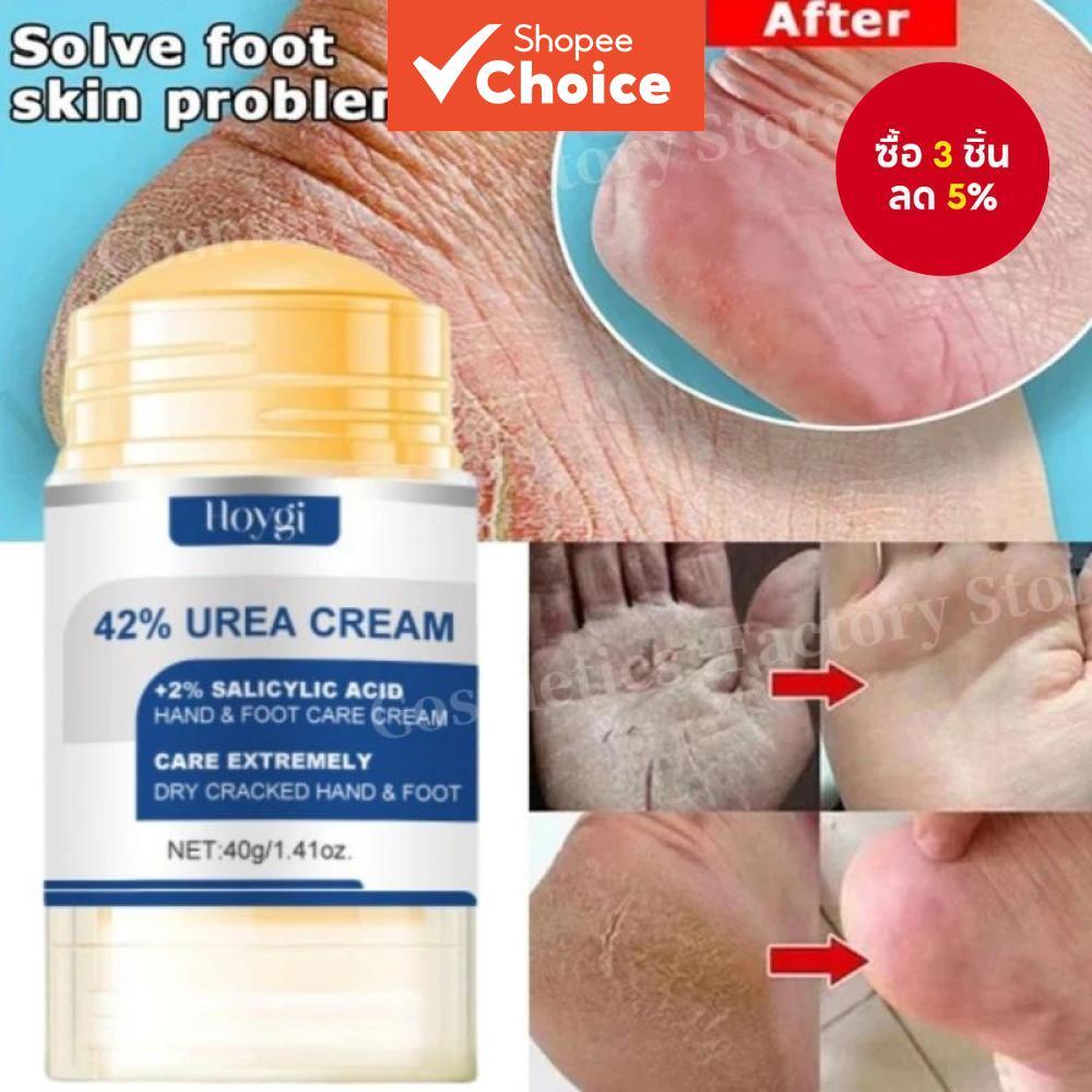 ครีมยูเรียเข้มข้น 60% และว่านหางจระเข้ 40 กรัม สําหรับเท้า - บํารุงล้ําลึกและให้ความชุ่มชื้นแก่เท้าแห้งแตก อ่อนโยนต่อการผลัดเซลล์ผิวประจําวัน อัพเกรดใหม่