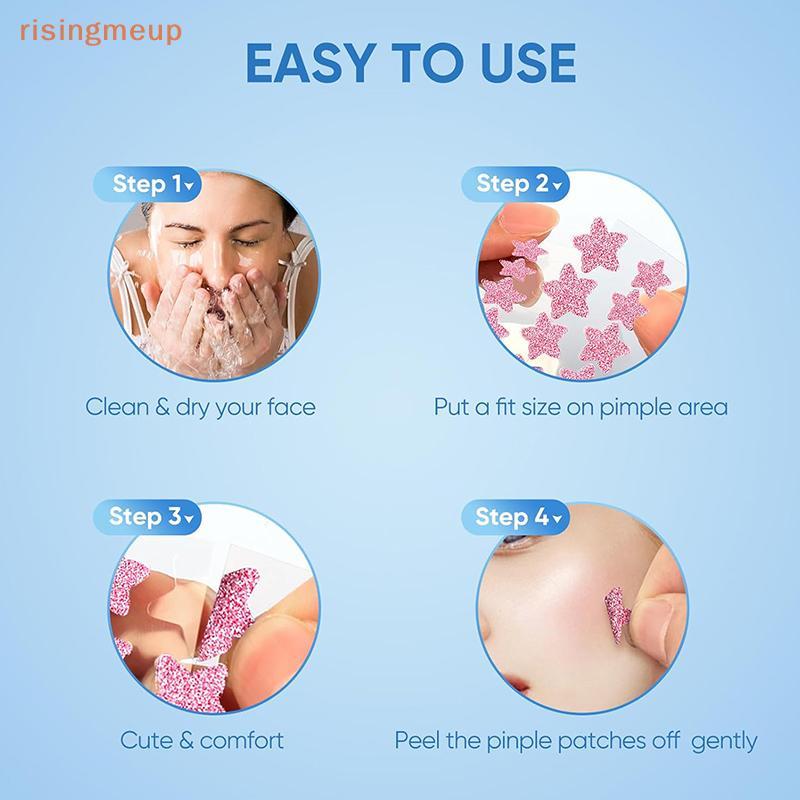 [risingmeup] 156/276 ชิ้น Acne Pimple Patch Stier Waterproof Acne Treatment Pimple Remover Tool มาส์