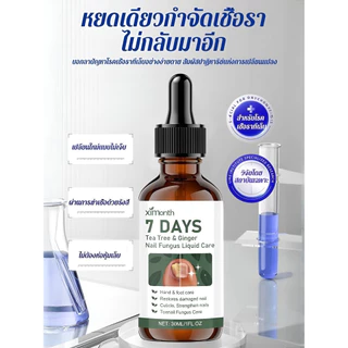 ✨การรักษาและบำรุงเล็บจากเชื้อรา/การฟื้นฟูสุขภาพเล็บ✨ SL-น้ำยาบำรุงเชื้อราเทียม/น้ำยารักษาเชื้อรา/ผลิตภัณฑ์บำรุงสุขภาพ【ช่วยกำจัดราที่อย่างมีประสิทธิภาพพร้อมให้แข็งแรงและสวยงาม】 น้ำยาสูตรเข้มข้นอ่อนโยนต่อผิวเล็บ/ส่วนประกอบจากธร