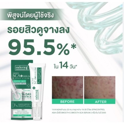 Smooth E Smooth Sca Serum 5g. ลดรอยและหลุมสิว สมูธ อี รูปที่ 8