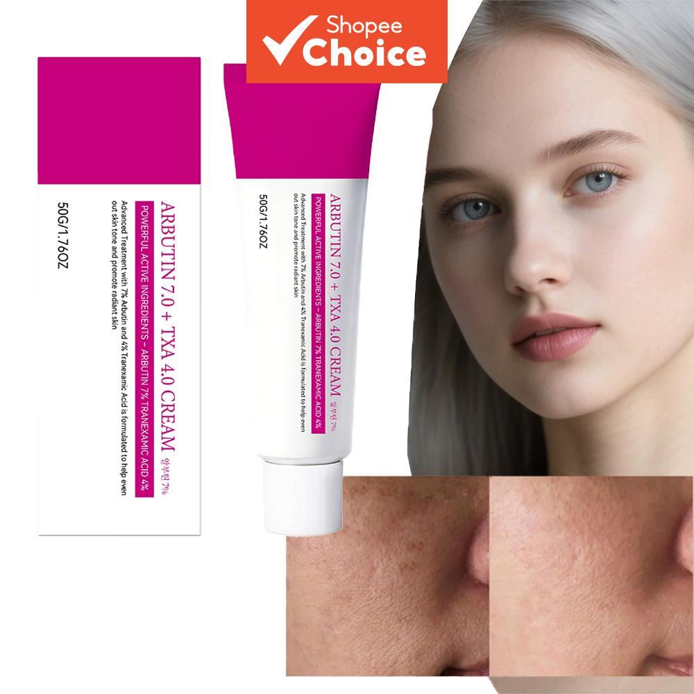 อาร์บูติน 7.0 + TXA 4.0 ครีมทาหน้าสําหรับจุดด่างดํา กระ ฝ้า และเม็ดสีผิวไม่สม่ําเสมอ ครีมให้ความชุ่มชื้นเพื่อผิวกระจ่างใส สําหรับผิวหมองคล้ําและสีผิวไม่สม่ําเสมอ 50 กรัม