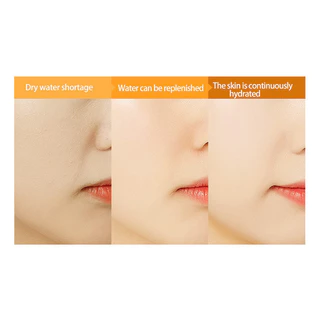 VC Mask【ซื้อ 15 แถม 15】SADOER หน้ากากวีซี มอบความชุ่มชื้นล้ำลึก ให้ผิวชุ่มชื้น สดชื่น ไม่มัน ทำให้ผิวนุ่มขึ้นและไม่แห้ง