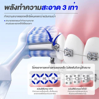 แปรงสีฟันจัดฟัน รูปตัว W แปรงจัดฟัน สำหรับคนจัดฟัน หัวเล็ก ขนนุ่ม ทำความสะอาดซอกฟันได้ดี อ่อนโยนต่อช่องปาก