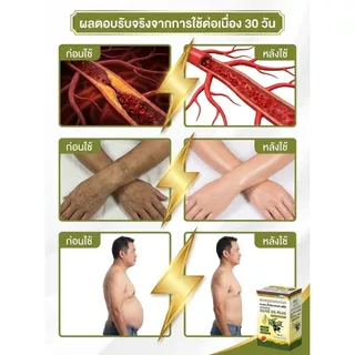 💥ซื้อ 2 แถม 3💥【น้ำมันมะกอก/บำรุงหลอดเลือด】แคปซูลน้ำมันมะกอก บำรุงหัวใจ สุขภาพดี เหมาะสำหรับผู้ใส่ใจสุขภาพ ส่งฟรี