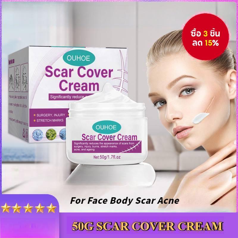 Scar Cover Cream for Face & Body - ปกปิดรอยสิว & Stretch Marks, Skin Repair Treatment, Natural-Looking Coverage, 50g