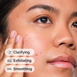 The Ordinary Salicylic Acid 2% Solution 30ml | เซรั่มลดสิวอุดตัน คุมมัน กระชับรูขุมขน ลดรอยสิว ผิวเรียบเนียนใส
