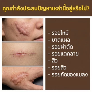 [รับประกันของแท้] Dermatix Ultra Gel 15g Advanced Formula Fade Old & New Scars | สูตรขั้นสูงช่วยลดเลือนรอยแผลเป็นทั้งเก่าและใหม่