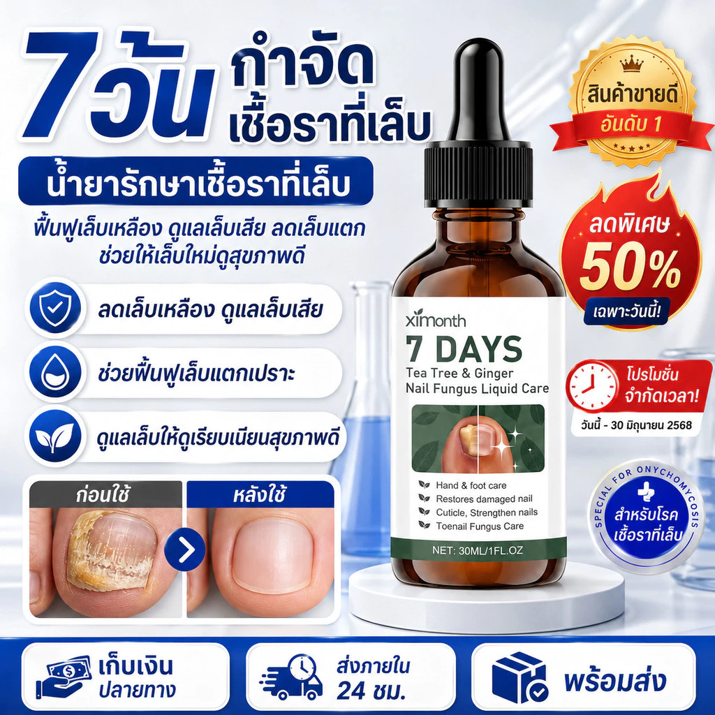 ✨การรักษาและบำรุงเล็บจากเชื้อรา/การฟื้นฟูสุขภาพเล็บ✨ SL-น้ำยาบำรุงเชื้อราเทียม/น้ำยารักษาเชื้อรา/ผลิตภัณฑ์บำรุงสุขภาพ【ช่วยกำจัดราที่อย่างมีประสิทธิภาพพร้อมให้แข็งแรงและสวยงาม】 น้ำยาสูตรเข้มข้นอ่อนโยนต่อผิวเล็บ/ส่วนประกอบจากธร