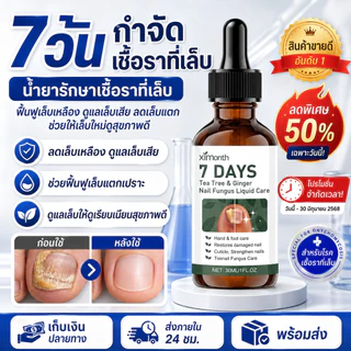 ✨การรักษาและบำรุงเล็บจากเชื้อรา/การฟื้นฟูสุขภาพเล็บ✨ SL-น้ำยาบำรุงเชื้อราเทียม/น้ำยารักษาเชื้อรา/ผลิตภัณฑ์บำรุงสุขภาพ【ช่วยกำจัดราที่อย่างมีประสิทธิภาพพร้อมให้แข็งแรงและสวยงาม】 น้ำยาสูตรเข้มข้นอ่อนโยนต่อผิวเล็บ/ส่วนประกอบจากธร