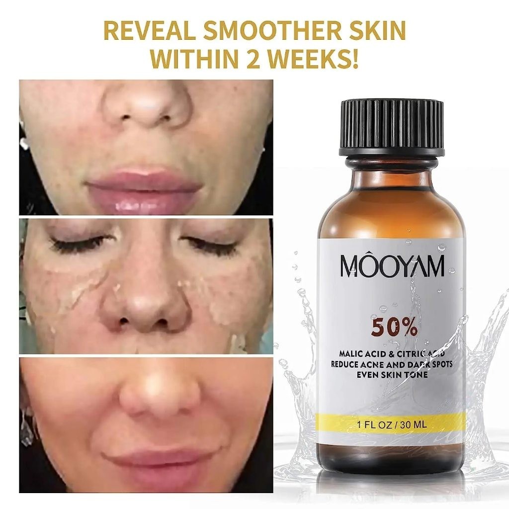 MOOYAM TCA 50% ผลัดเซลล์ผิว ลดรอยสิว หลุมสิว จุดด่างดำ ฝ้า กระ ริ้วรอย กระชับผิว กระจ่างใส ต่อต้านวั