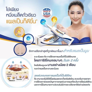 [รับประกันของแท้] Dermatix Ultra Gel 15g Advanced Formula Fade Old & New Scars | สูตรขั้นสูงช่วยลดเลือนรอยแผลเป็นทั้งเก่าและใหม่