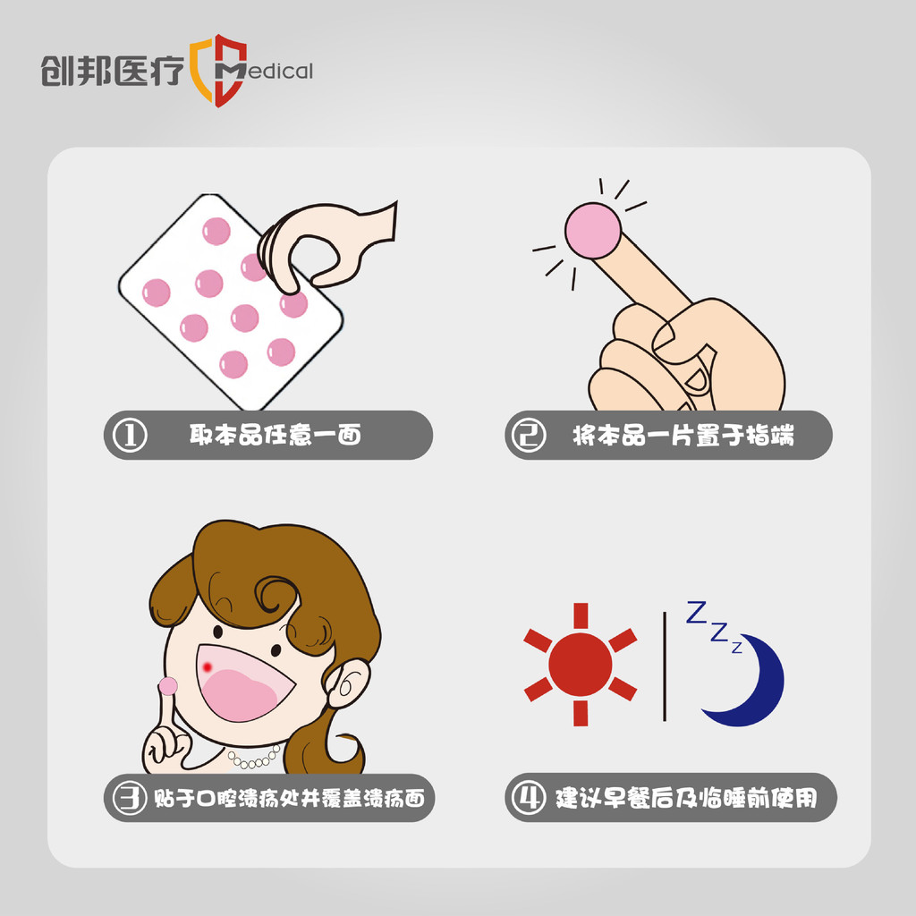 Chuangbang Medical Oral Ulcer Patch Oral Ulcer ฟิล์มหญิงตั้งครรภ์เด็ก Oral Patch Ulcer ฟิล์ม/Cola