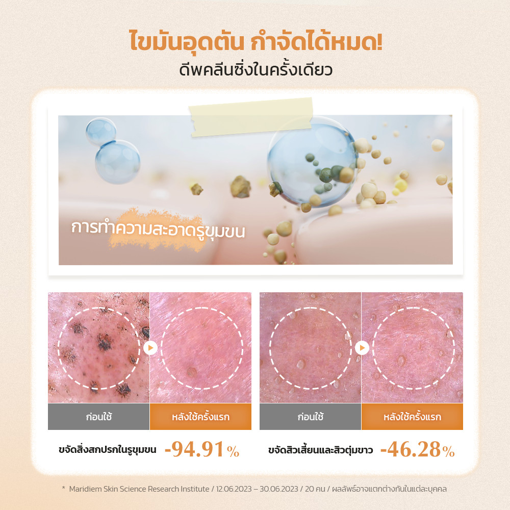 UIQ Biome Barrier Collagen Firming Cleansing Balm รูปที่ 6
