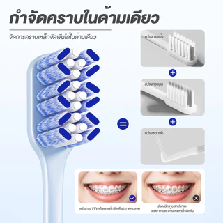 แปรงสีฟันจัดฟัน รูปตัว W แปรงจัดฟัน สำหรับคนจัดฟัน หัวเล็ก ขนนุ่ม ทำความสะอาดซอกฟันได้ดี อ่อนโยนต่อช่องปาก