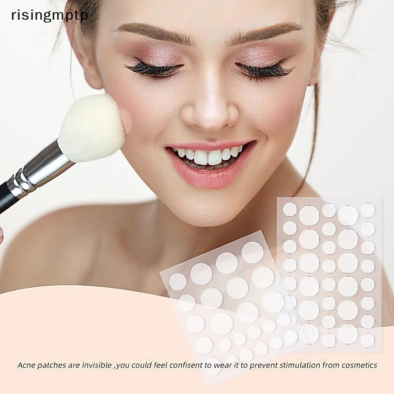Risingmptp] 24/36 แพทช์ Hydrocolloid Pimple Patch วงกลมสีขาวกันน้ํารูปร่างจุดสิว Treatment คอนซีลเลอร์แพทช์ใหม่
