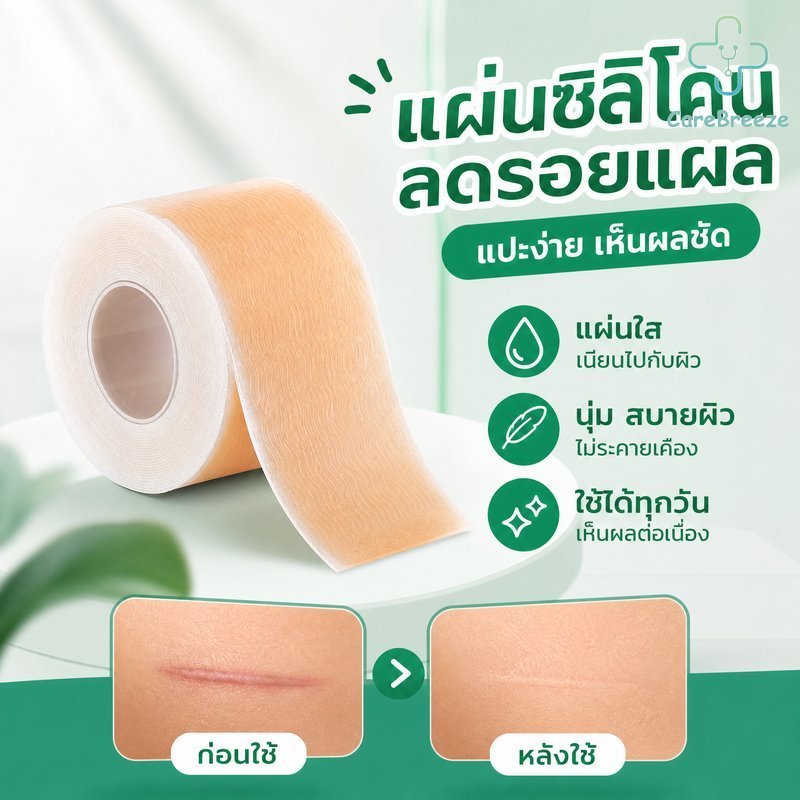COD แผ่นแปะรอยแผลเป็น ซิลิโคนลดคีลอยด์ แผลผ่าตัด กันน้ำ ใช้ซ้ำได้ ระบายอากาศ ตัดได้ แบบม้วน
