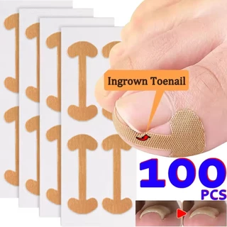 20/100 ชิ้น Professional คุด Toenail Correction สติกเกอร์ - Foot Corrector Anti Infection Nail Treatment Patch Toe Care