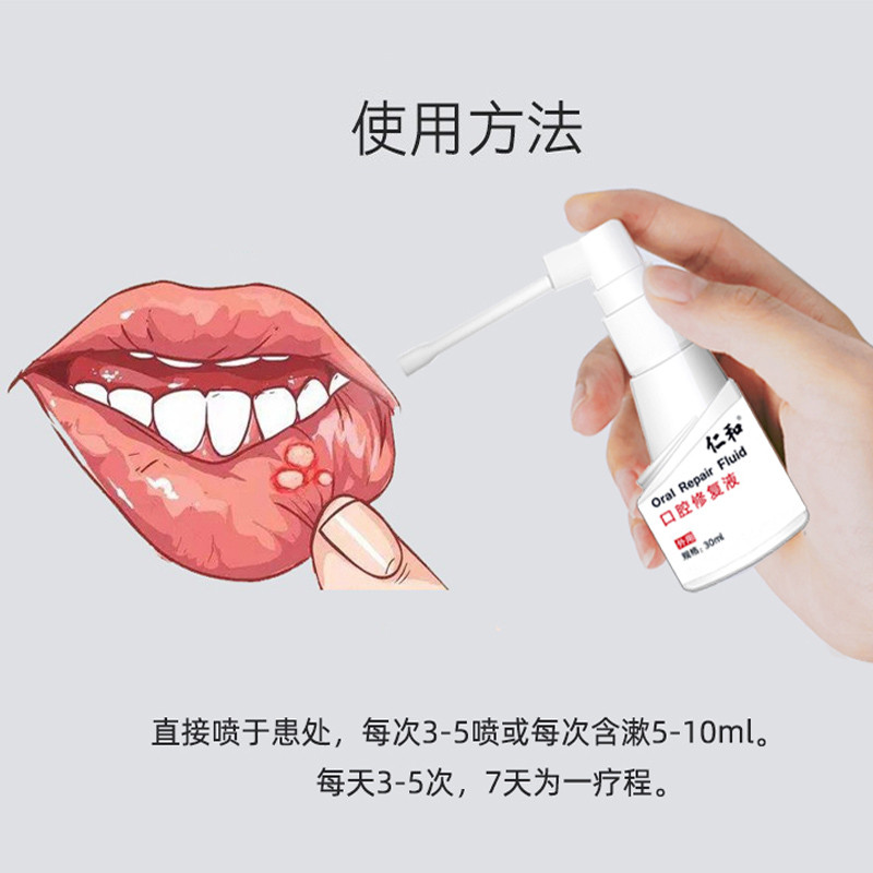Renhe Oral Repair Liquid Oral Ulcer สเปรย์สเปรย์หมากฝรั่งบวม Mucous เมมเบรน Ulcer Patch Care สินค้าข