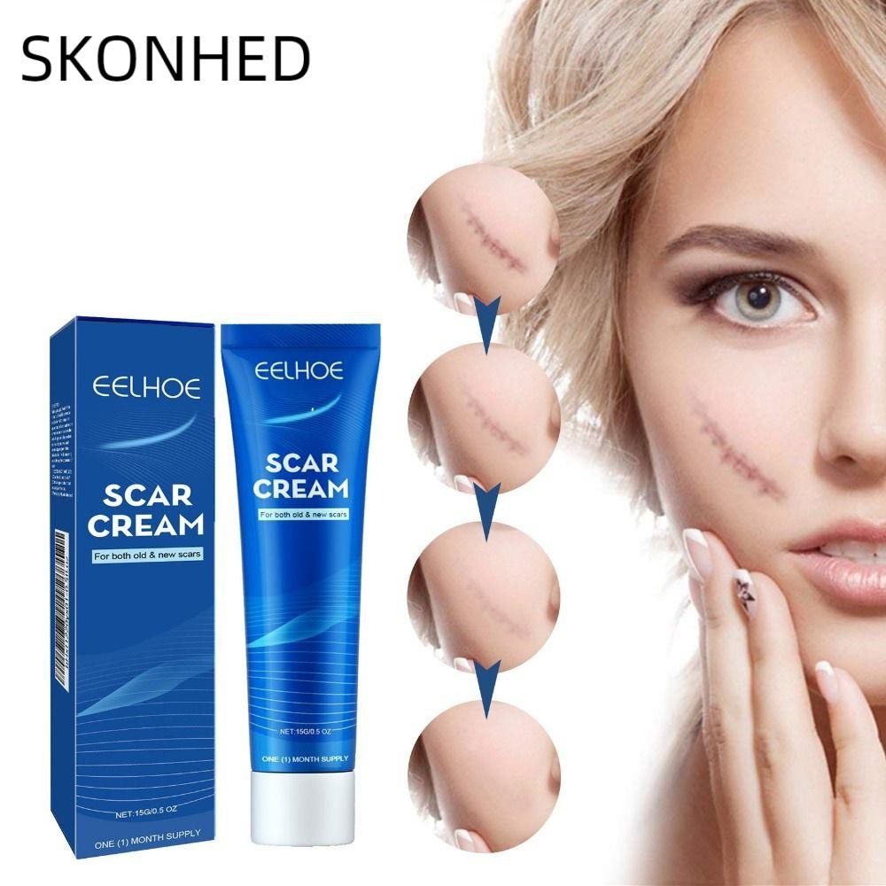 SKONHED Scar Gel, Moisturizing Smoothing Pure Natural Scar Cream, 0.53oz Plant Extraction Gentle Ski