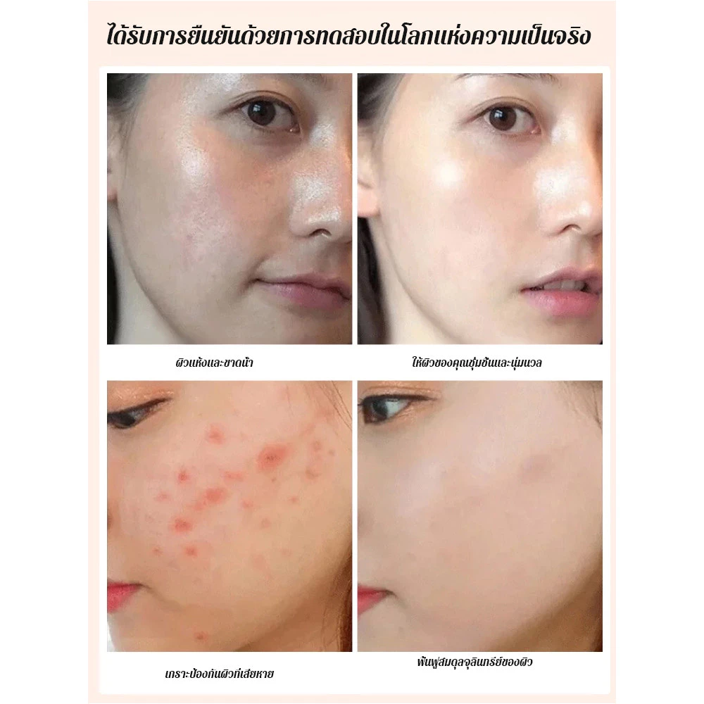 สุขภาพ ดอกและผลไม้ฟรี ของว่าง ต่อต้านความเหนื่อยล้า หวานและนุ่มนวล โภชนาการ ตอบสนองความอิ่ม ผลไม้แห้ง แถบผลไม้แห้ง อร่อยและอร่อย สํานักงาน ล่อ thumbnail 8