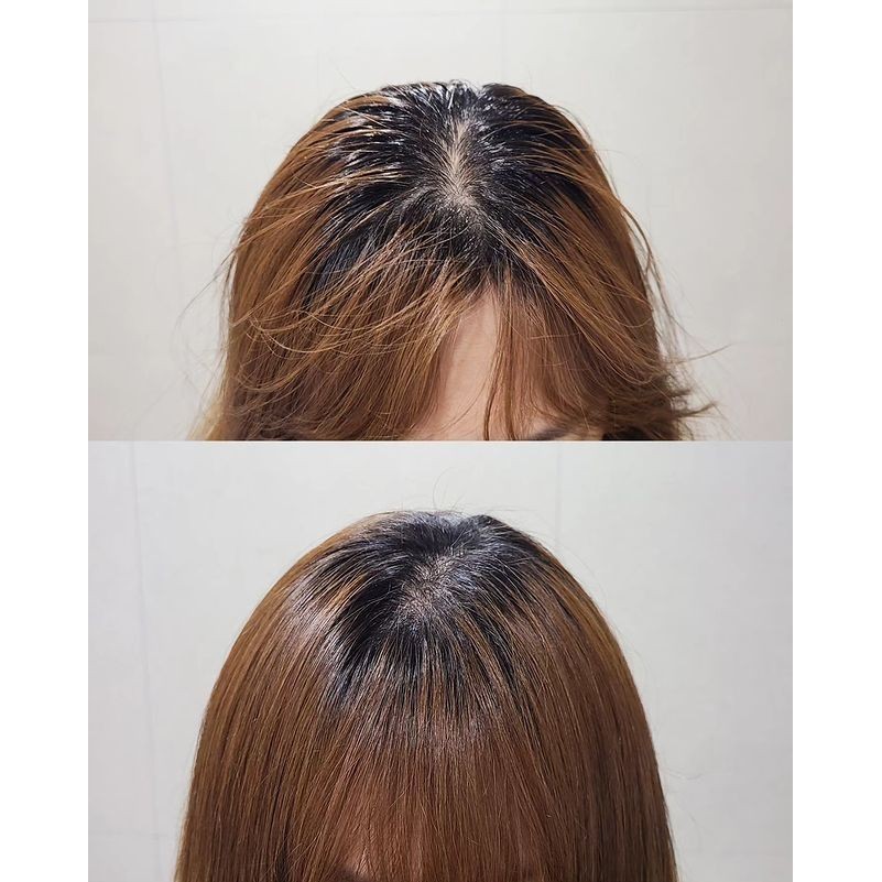 ✅พร้อมส่ง ถูกที่สุด ของแท้ (เขียว) HEADSPA7 SHAMTREA SHAMPOO FRESH AMPOULE 500 ml - รูปที่ 6