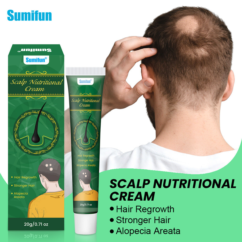 Sumifun Green Diamond Spot Bald Cream ครีมข้ามพรมแดน ยา บํารุงผม K102929.9