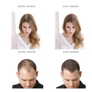 Immetee 14.15g ผม Thickener เคลือบผงผม Danger Growth Fiber Powder ชั่วคราวซ่อม Hairline ผงธรรมชาติเพิ่มเติมเส้นใยผง