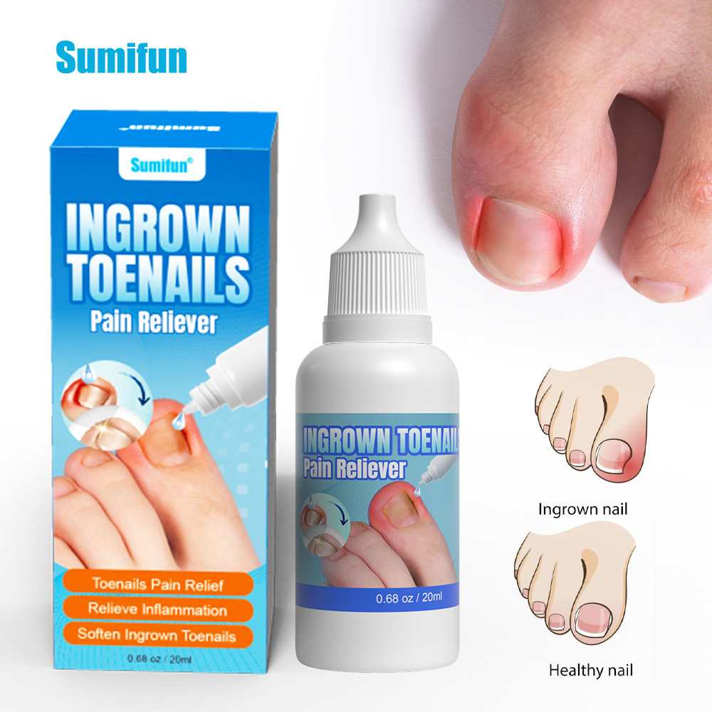 Sumifun Nail Groove Health Care Solution Cross-Border Onychomycosis Repair Solution Crooked Nails St