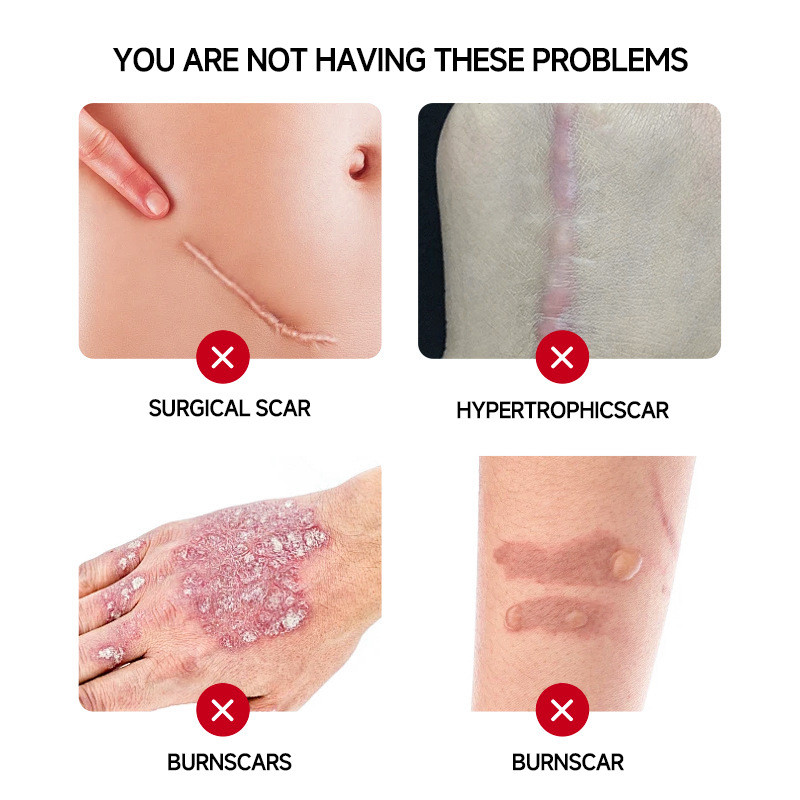 All English Scar Cream 0g Remove Repair Soothing Skin Surgery เพิ่มหลังคลอด Old Scar Cream OEM bu93