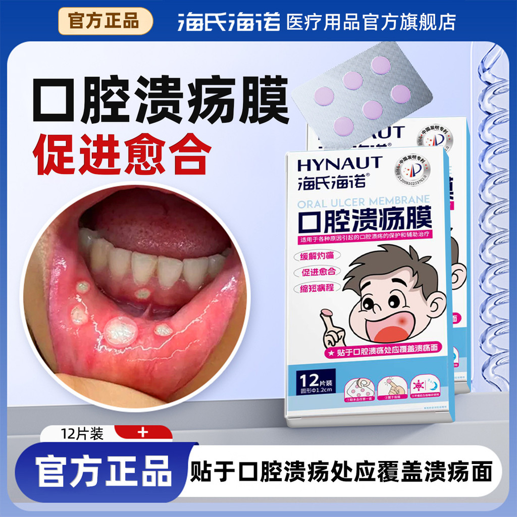 สินค้าใหม่พร้อมสต็อก Heine Heino Oral Ulcer Mask บรรเทาการเผาไหม้ส่งเสริม Healing Oral Ulcer Patch O