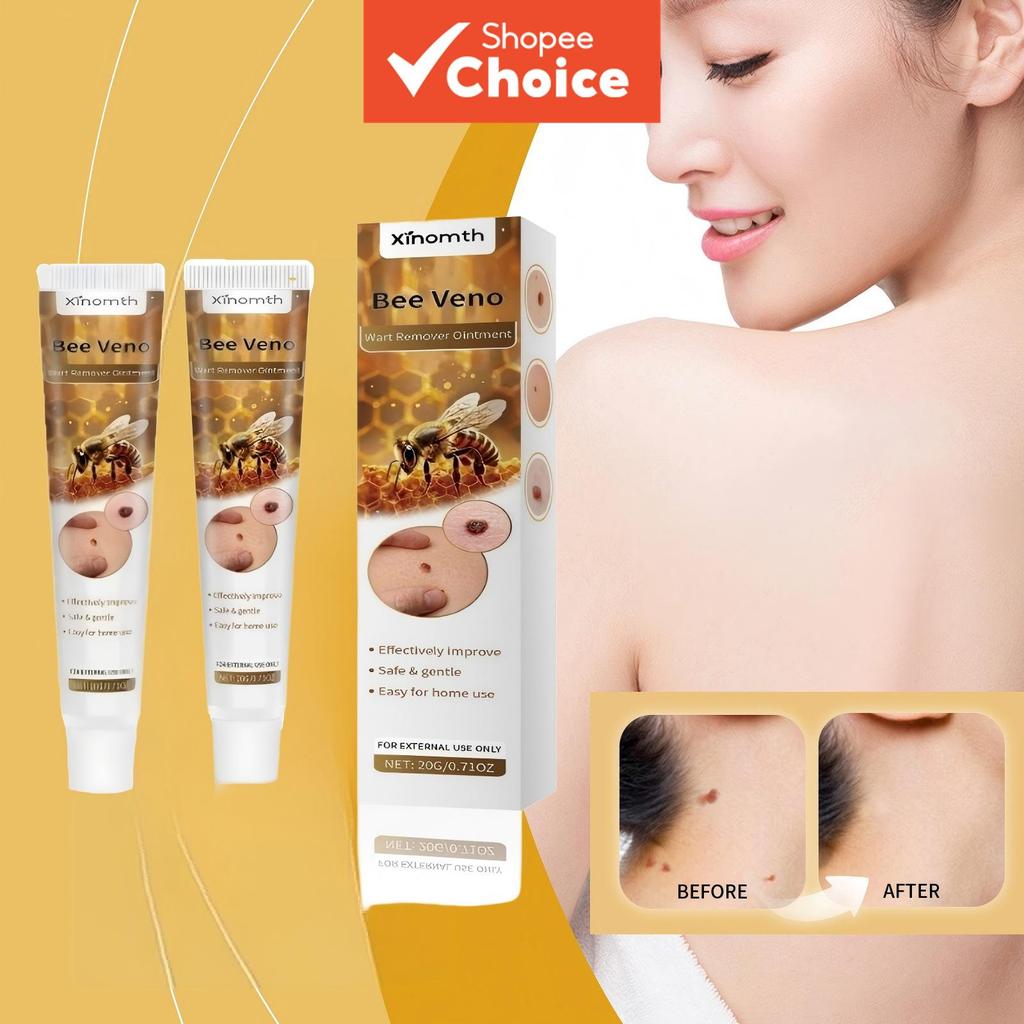 Xinomth Bee Venom ครีมกําจัดหูดอ่อนโยนต่อผิธรรมชาติ 2 ชิ้น