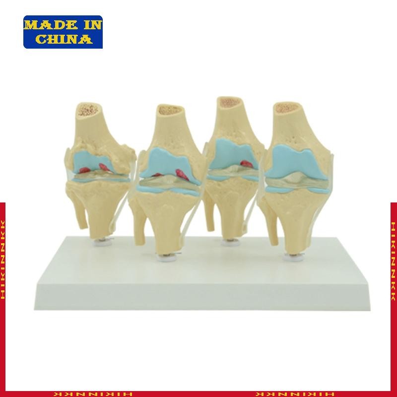 HIK ยืดหยุ่น Human Knee Joint Anatomy รุ่น Comparison of Knee Joint รุ่นวิทยาศาสตร์ขนาดชีวิตสําหรับ 