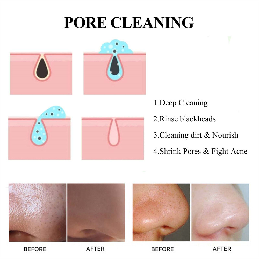 COD Mud Mask มาส์กโคลนสติ๊กแก้ผิวมัน สิวหัวดำ รูปที่ 7