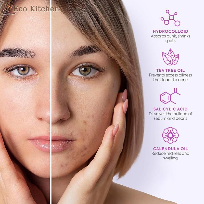 [Eco Kitchen] 128 ชิ้น/เซ็ต Pimple Patch สิวที่มีสีสันที่มองไม่เห็น Skin Care สติกเกอร์คอนซีลเลอร์ F