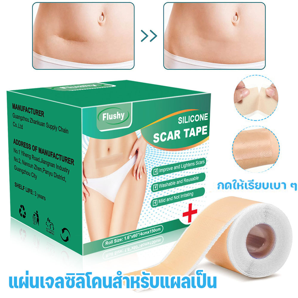 แผ่นแผลสิวคีลอยด์ หลังผ่าคลอด กันน้ำ ทางการแพทย์ แผ่นซิลิโคนลดแผลเป็น ไร้รอยแตกลาย