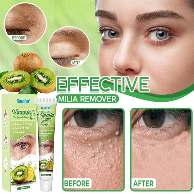 20g ไขมัน Granule ครีมวิตามินอี Krim Milia Seed Remover Eye ครีมไขมัน Granule Syringoma Milia Remover จาระบีธัญพืช Eye Health Care - รูปที่ 5