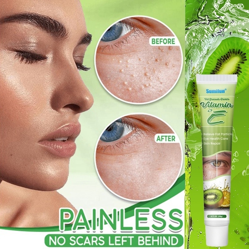 20g ไขมัน Granule ครีมวิตามินอี Krim Milia Seed Remover Eye ครีมไขมัน Granule Syringoma Milia Remover จาระบีธัญพืช Eye Health Care - รูปที่ 2