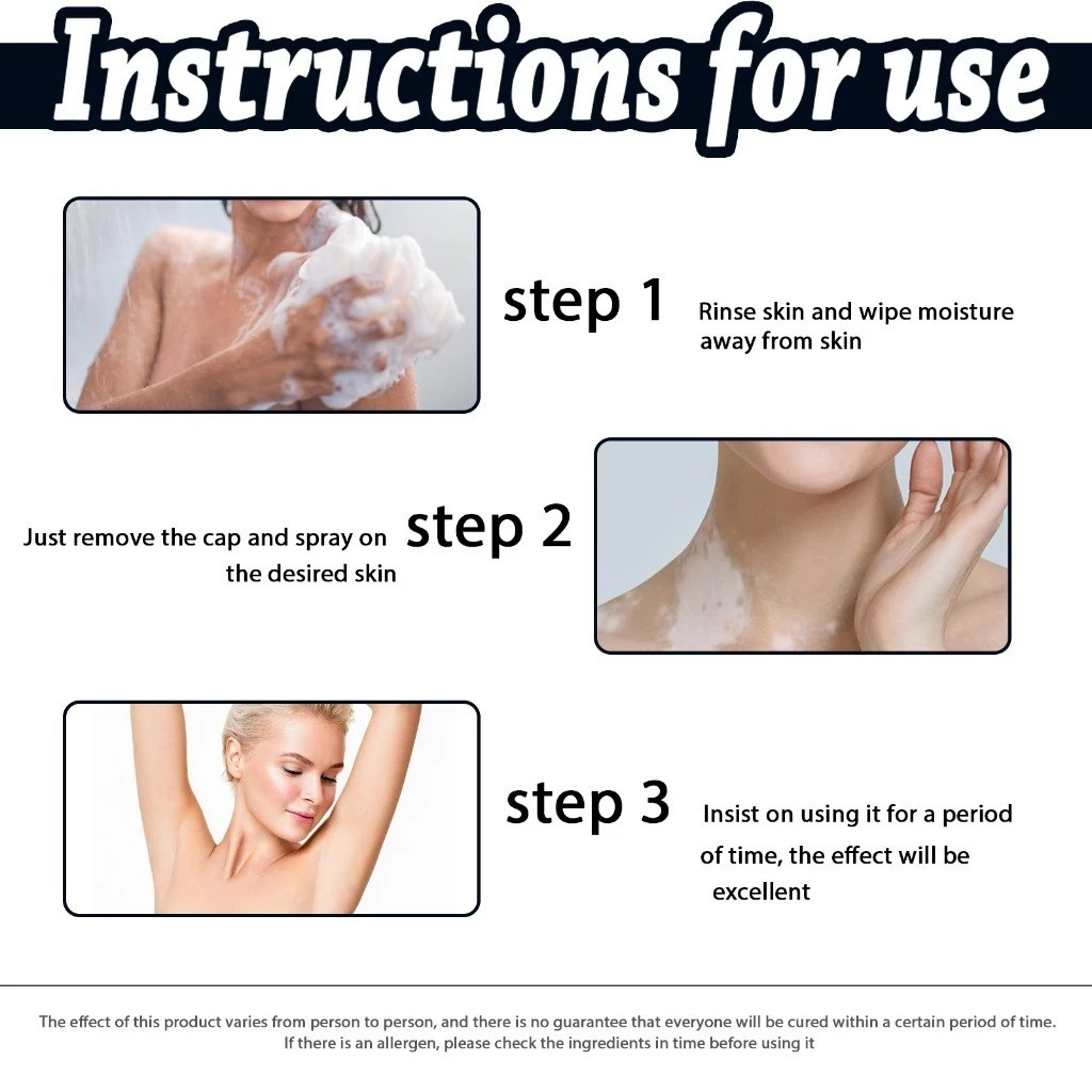 30ml {จัดส่งทันที} ครีมรักษา vitiligo ครีม vitiligo ครีม vitiligo น้ํายาล้าง กลายเป็นด่างขาว**-& - รูปที่ 7