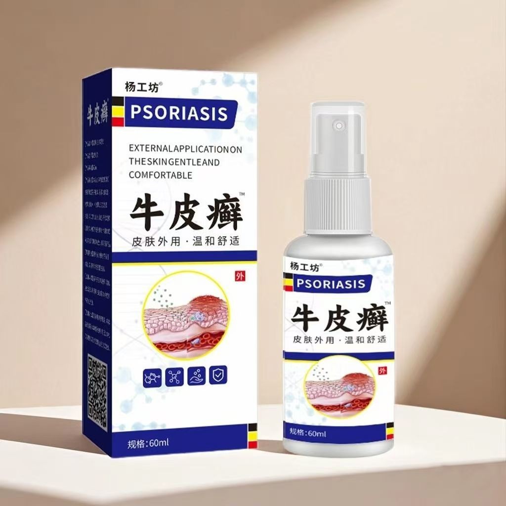 Yang Workshop Cowhide Raising Silver Raising Special Spray Head Raising Body Raising Hand Foot Peeli