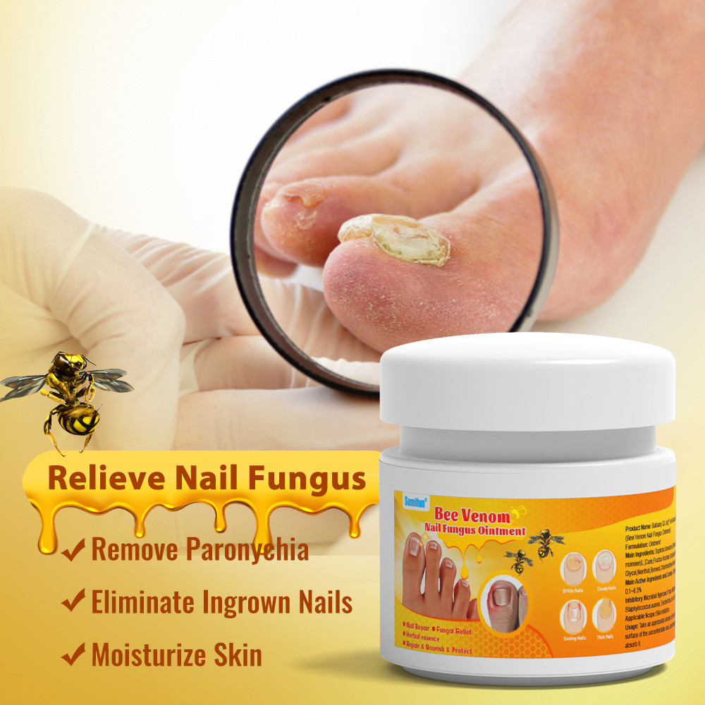Sumifun Nail Groove Health Cream ครีมเล็บสดใสใหม่ Onychomycosis ครีมซ่อมแซมเล็บเท้าครีมต้านเชื้อแบคท