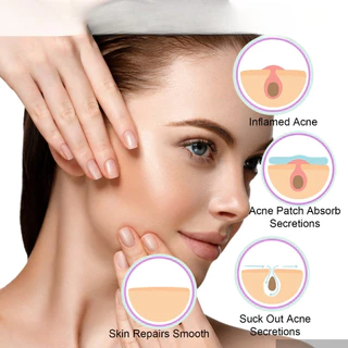 แผ่นแปะสิวที่มองไม่เห็น – สติ๊กเกอร์กําจัดสิวสําหรับซ่อมแซมสิวและการรักษารอยแผลเป็น
